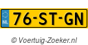 76STGN