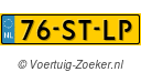 76STLP